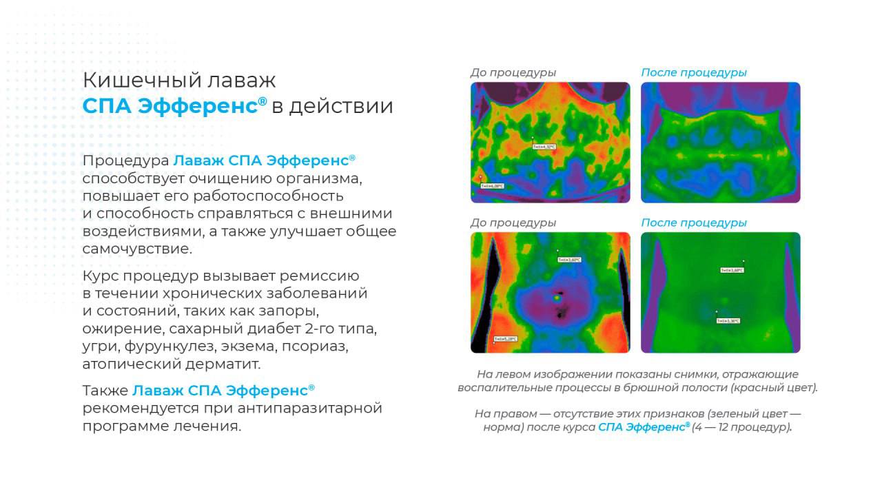 LifePro, Лаваж Спа Эфференс, Комплект для приготовления раствора
