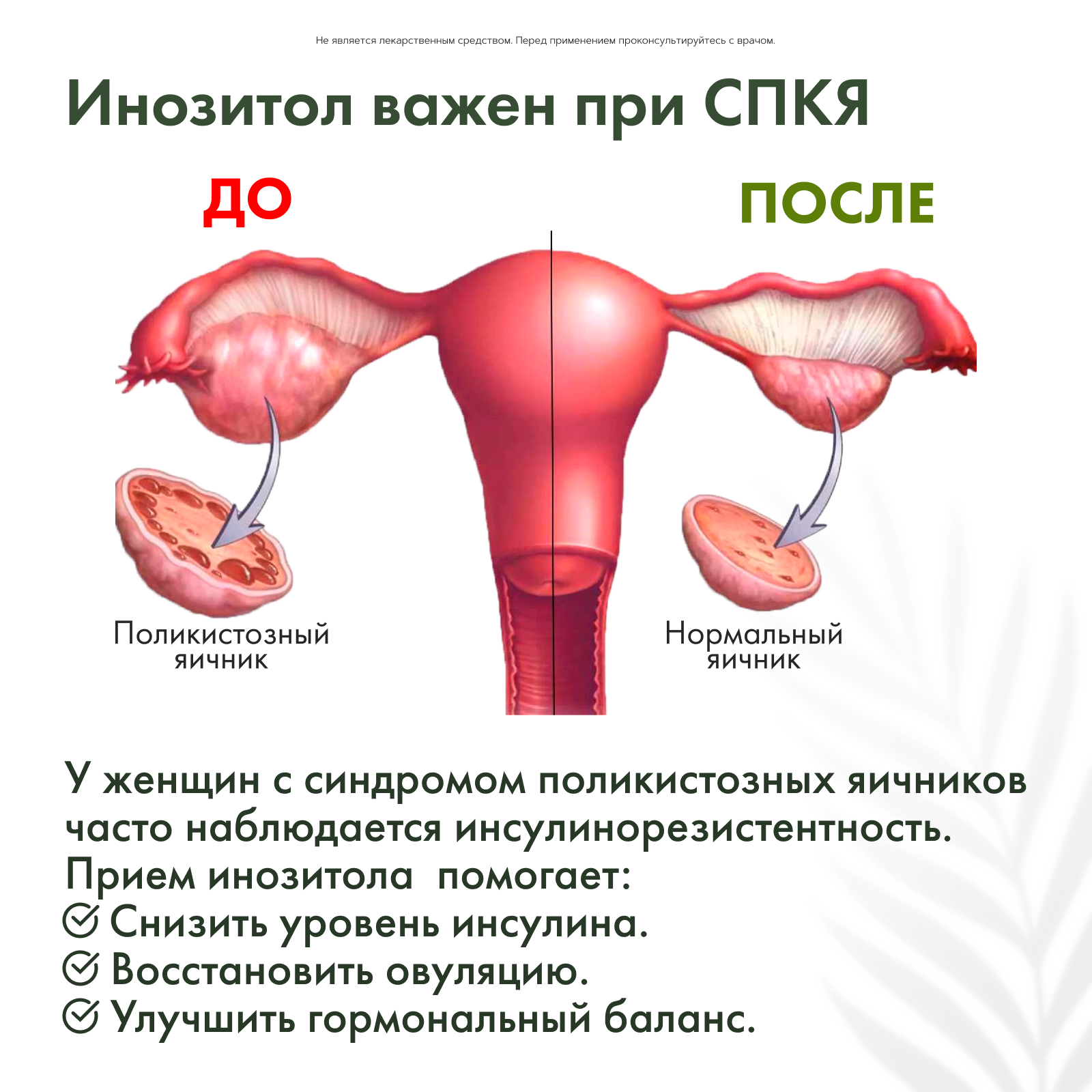 Restartbio, Инозитол (мио-инозитол), капсулы, 60 шт.
