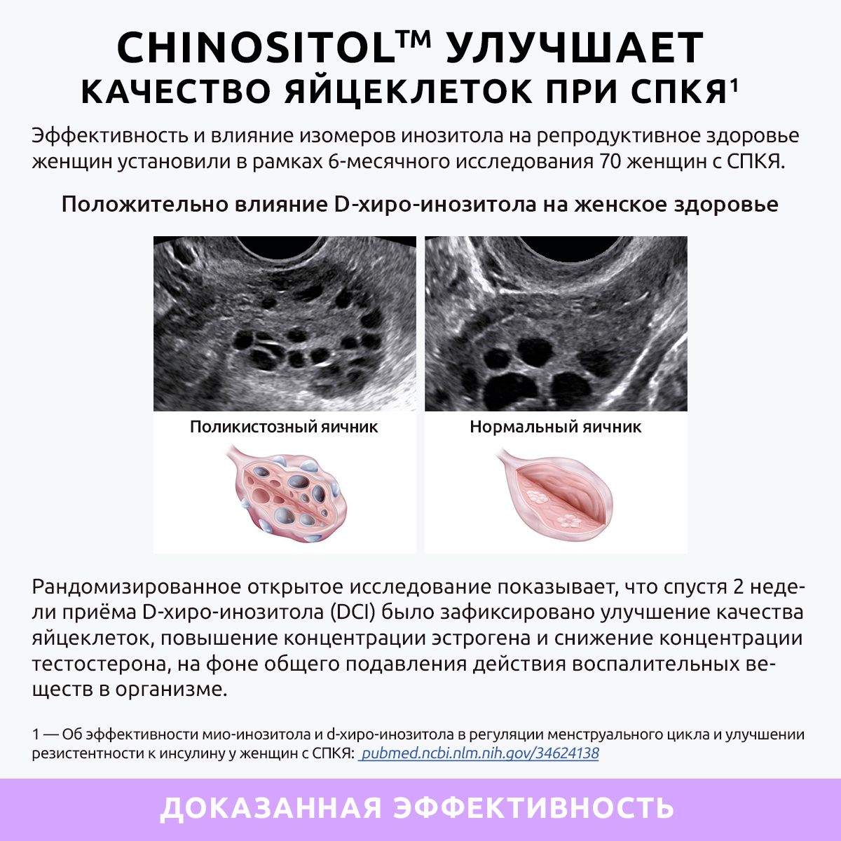 Ultrabalance, Инозитол (мио + d-хиро), капсулы, 60 шт.