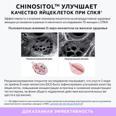 Ultrabalance, Инозитол (мио + d-хиро), капсулы, 60 шт.