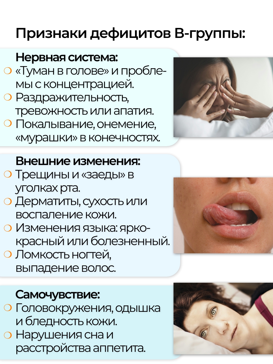 NMDIET, Комплекс витаминов группы В, капсулы, 30 шт.